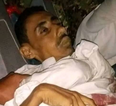 اشتباكات بين فصيلين لمليشيا الحوثي غرب تعز توقع إصابات في صفوفهما ومقتل مدني