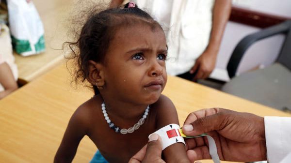 اليمن: 9 ملايين طفل بحاجة لخدمات صحية عاجلة مع دخول الحرب الحوثية عامها العاشر