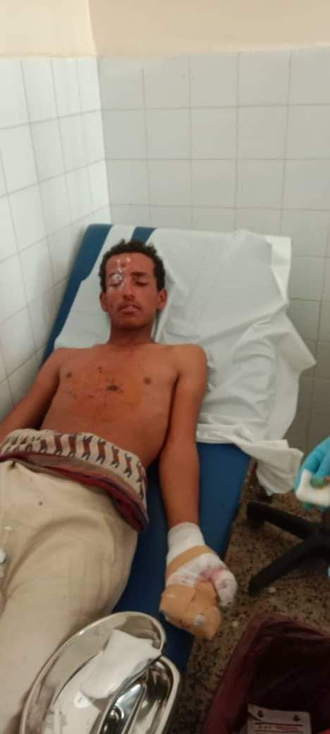إصابة مواطن في محافظة البيضاء بانفجار مقذوف حوثي