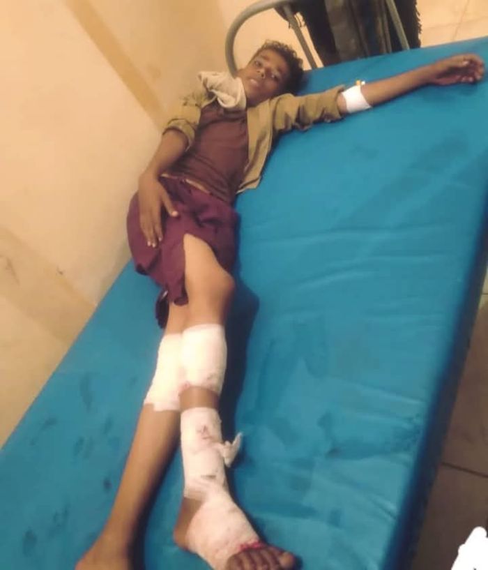 تعز.. إصابة طفل بجروح جراء انفجار مقذوف حوثي في الوازعية