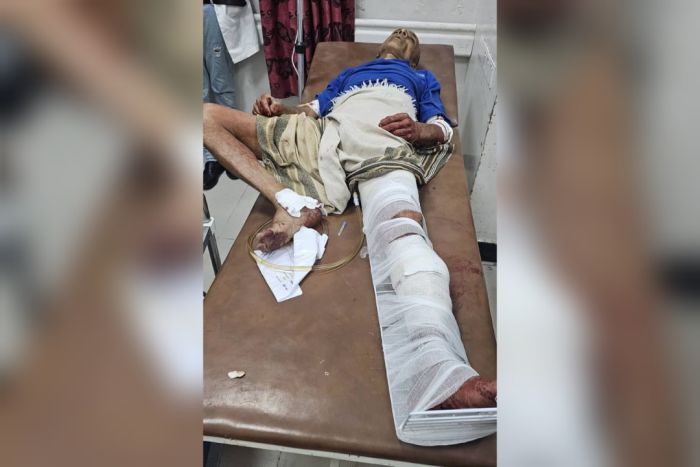 في ثالث حادث يتعرض له.. إصابة مسن برصاص قناص حوثي في مدينة تعز